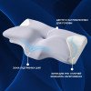 Подушка ортопедическая ErgoSleep 61х34х12 см IDEIA анатомическая с эффектом памяти и наволочкой на молнии (8-35857)